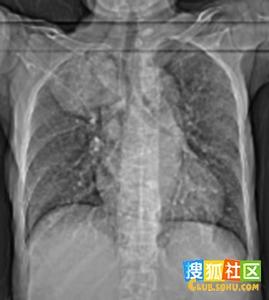 d75c17f5abe8e767575d363701dd08b0.jpg